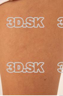 Skin texture of Lon 0003